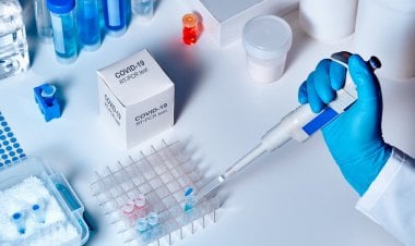 دواء لالتهاب المفاصل قد يعالج كورونا