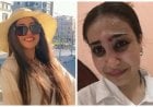 كنت بأدبها... فتاة مصرية ترفض التنازل عن مقاضاة والدها بعد تعنيفها