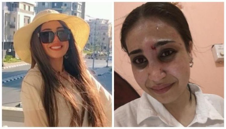 كنت بأدبها... فتاة مصرية ترفض التنازل عن مقاضاة والدها بعد تعنيفها