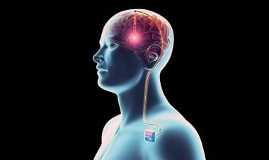 تقنية جديدة تمنح بارقة أمل للبشرية... مصاب بالشلل يستطيع المشي